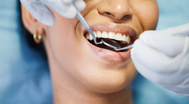 Best Emergency Dental Care for Sports Injuries in Milton, GA