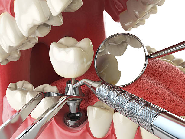 Best Weekend Emergency Dental Services in Milton, GA